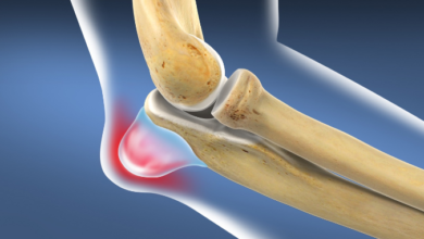 Olecranon Bursitis in Famous Athletes