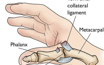 What Famous Athlete Had the Injury Gamekeeper Thumb Injury